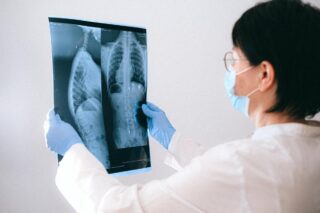 Patient Education Lung Cancer Screening
