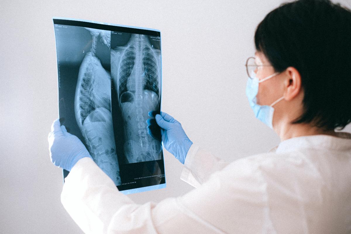 Lung cancer screening awareness is low. How can the industry get the word out?